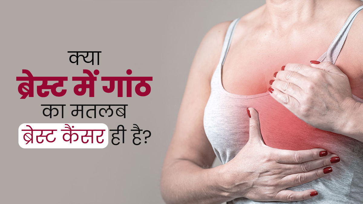 क्या स्तन में गांठ होना हमेशा ब्रेस्ट कैंसर का संकेत होता है? डॉक्टर से जानें कैसे करें पहचान